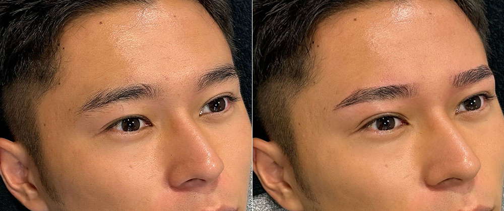 メンズアイブロウのビフォーアフター