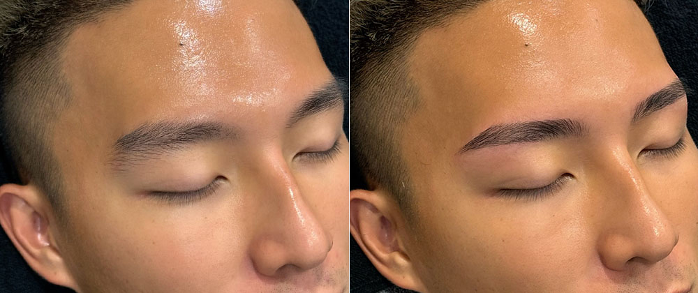 メンズアイブロウのビフォーアフター