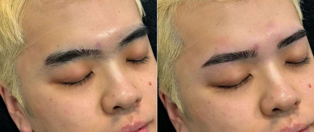 メンズアイブロウのビフォーアフター