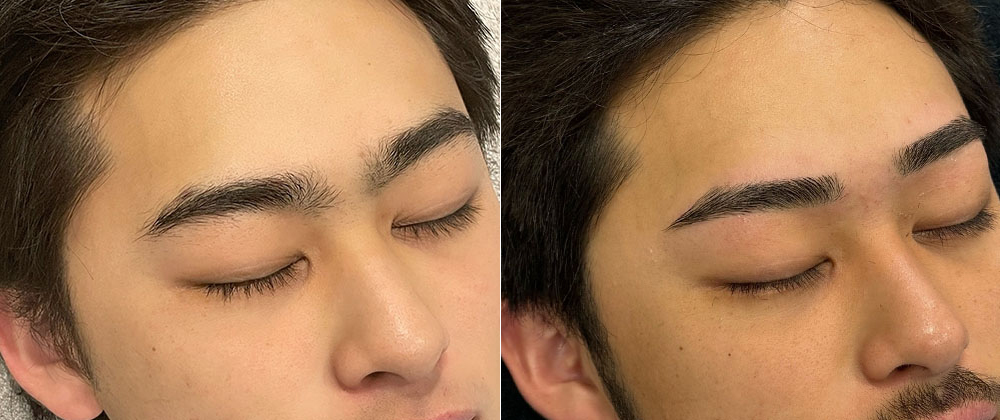 メンズアイブロウのビフォーアフター